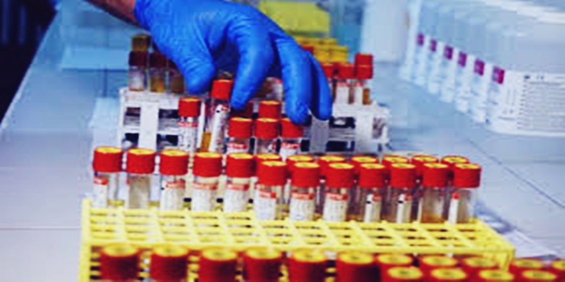 Karabük’te 1122 hanede PCR ve antikor testleri başlıyor